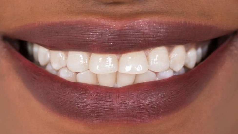 Какого цвета ваши зубы? Cоветы стоматолога