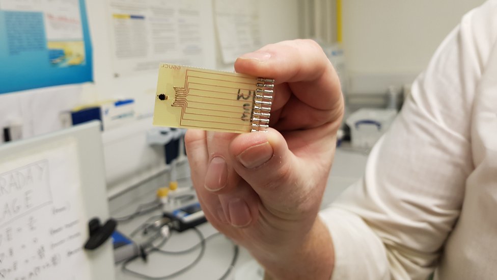 Sepsis: New rapid test 'could save thousands of lives'