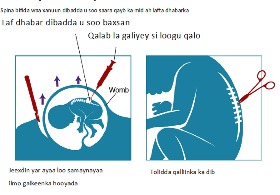 Dost singlisi bilan jinsiy aloqada boladi