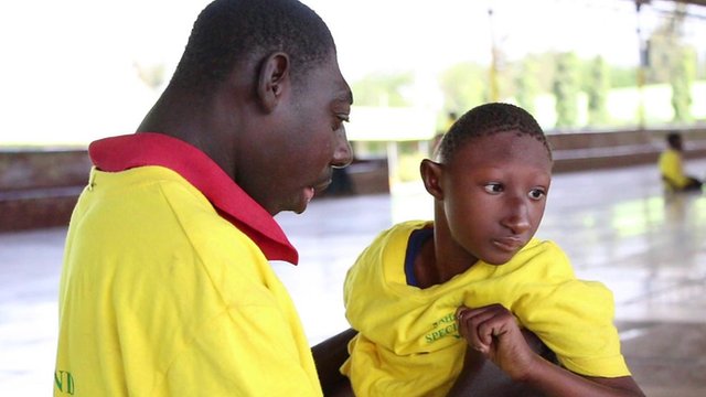 Image result for microcephaly baby in kenya