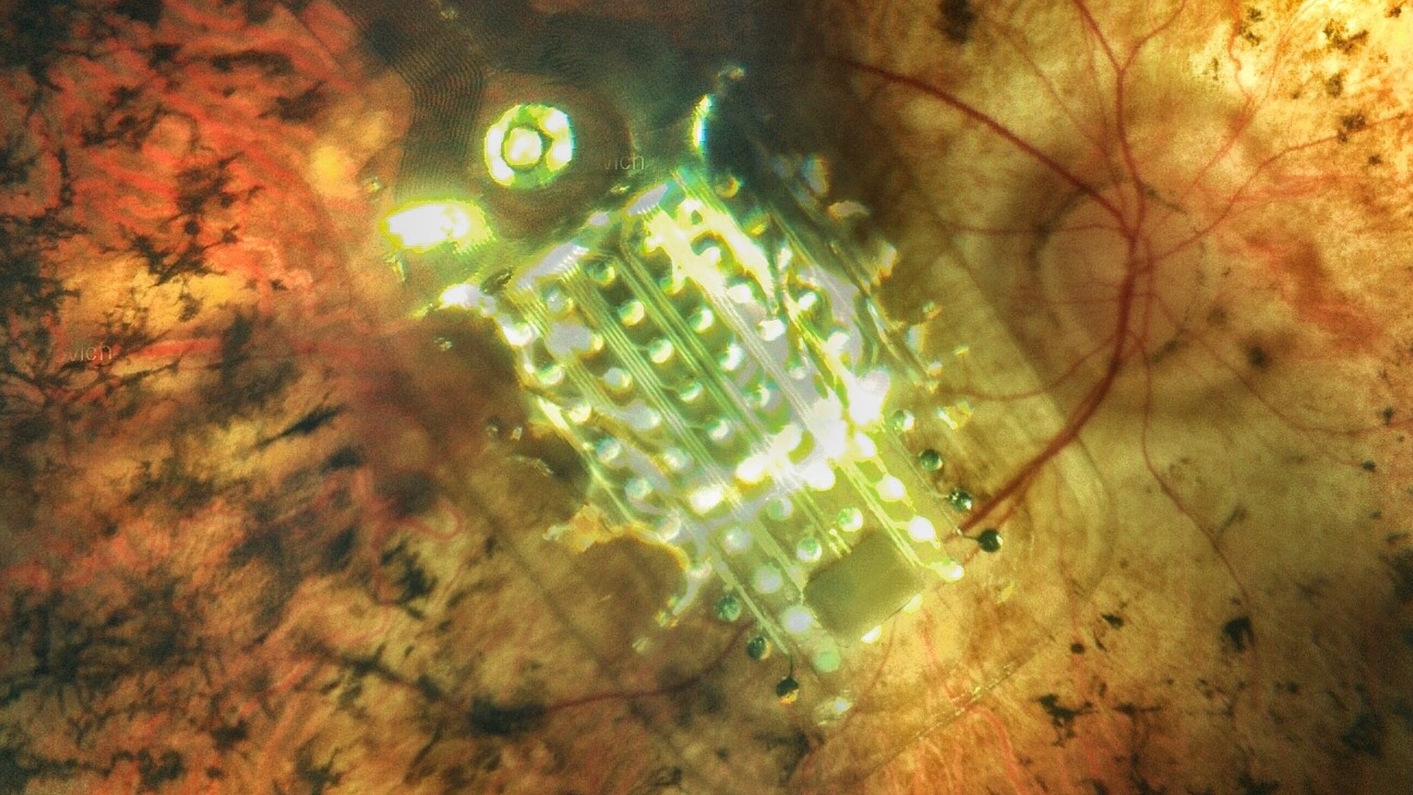 Впервые создан бионический глаз с искусственной сетчаткой