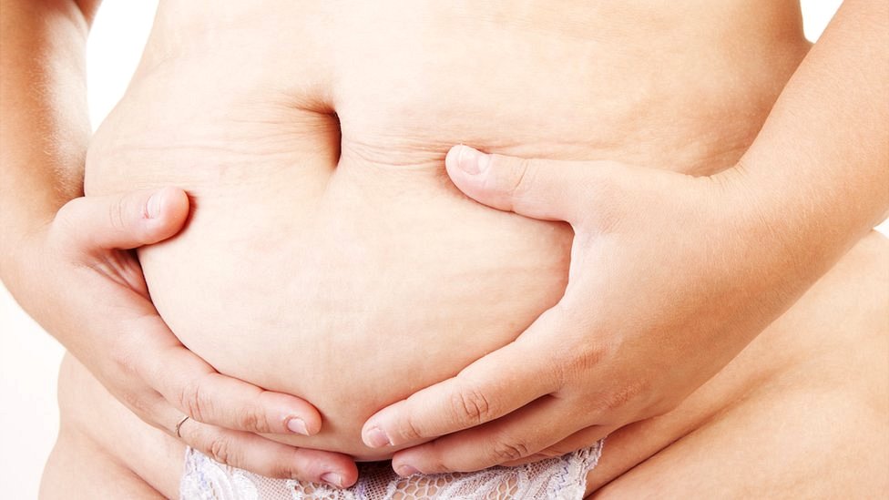 Espaço Fisio - Que tipo de barriga ficou depois da gravidez? Será