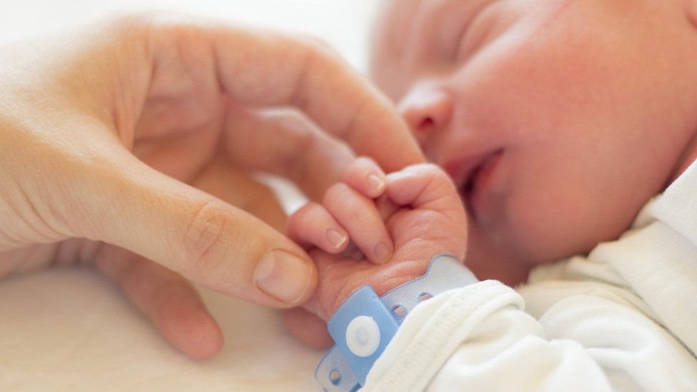 В Самарской области впервые родился ребенок-гермафродит