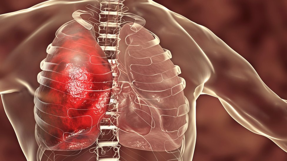 Biz balkonda seks qildik