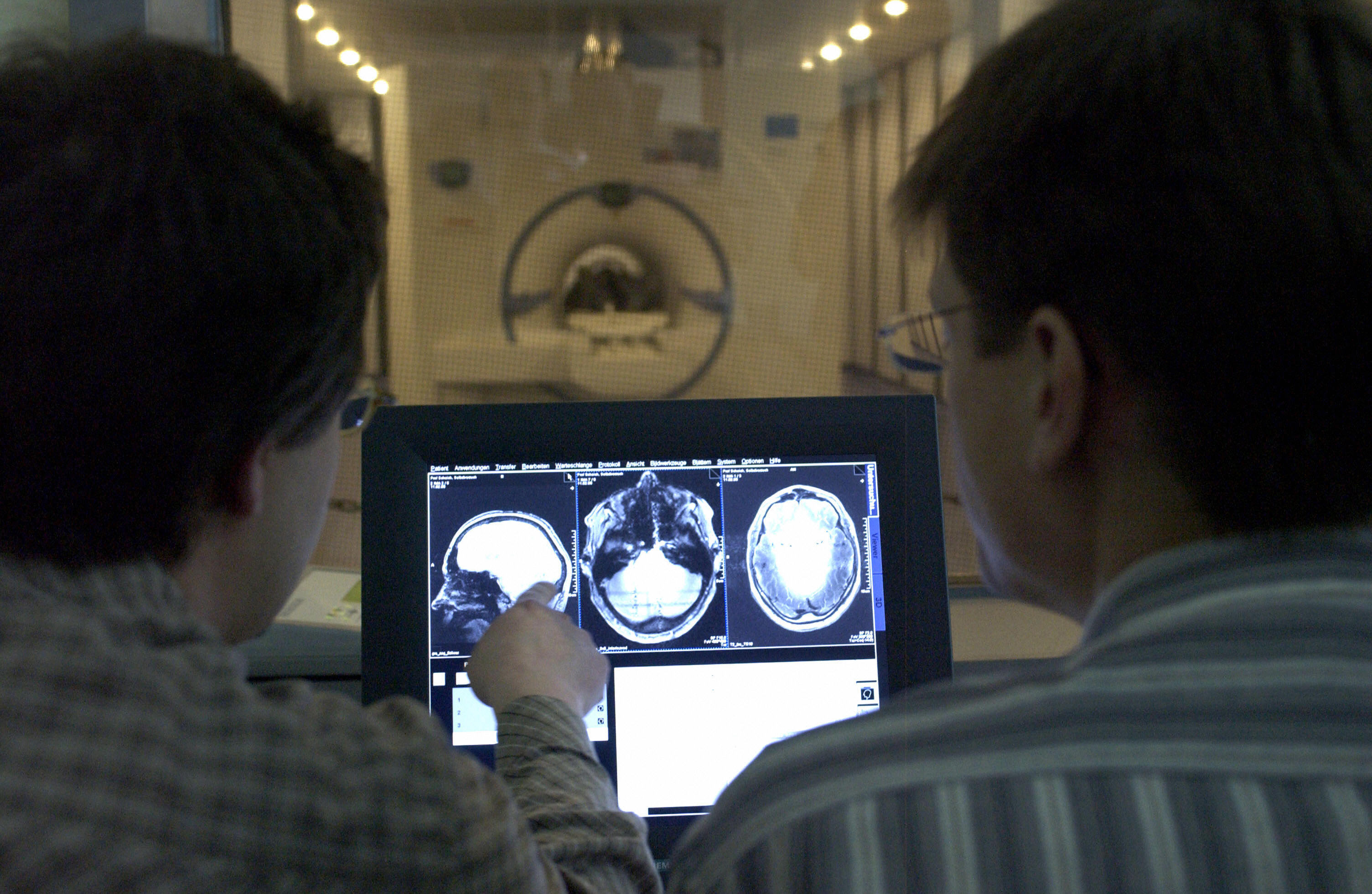 Investigadores miran resonancia magnética del cerebro