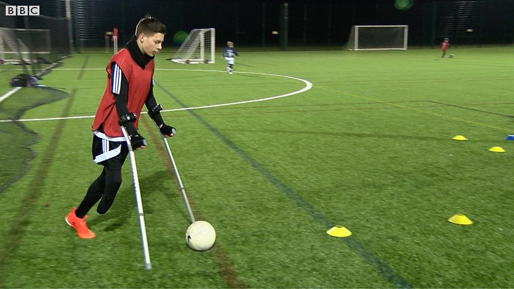 Cambridge United set up training for amputee footballers