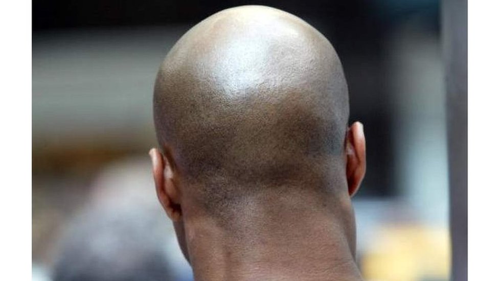 Tabiiy yalangoch qizlarning foto galereyasi