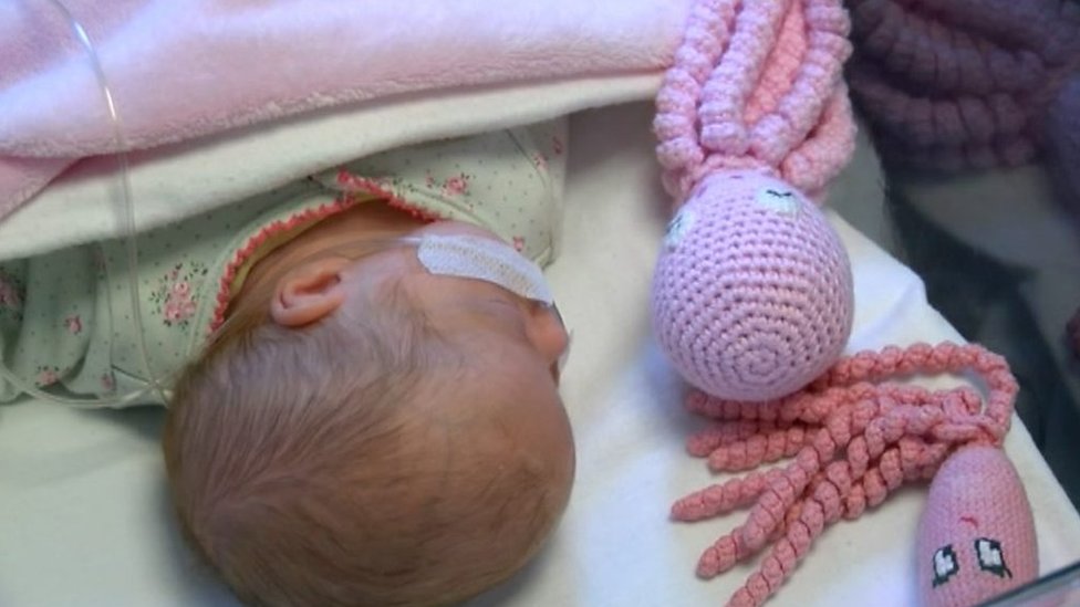 Bebé prematuro con un pulpo de calceta