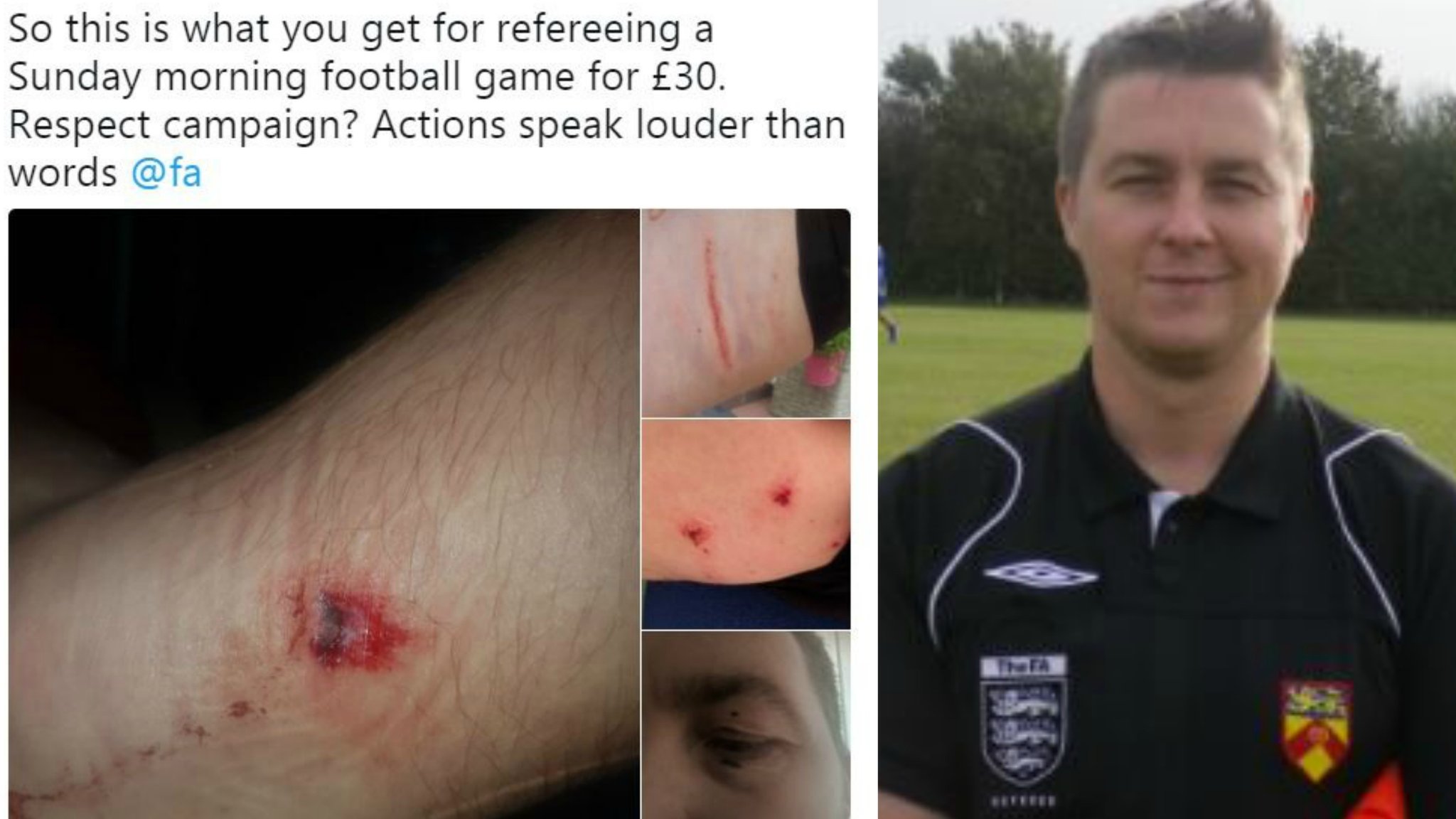 '£30 to be punched and kicked' - Sunday football ref quitting after second alleged assault