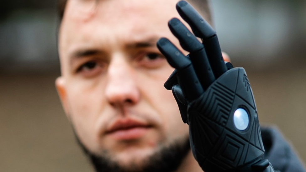 'I'm going back to the frontline with my bionic arm'