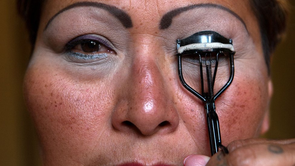 Chol klitorisni soradi