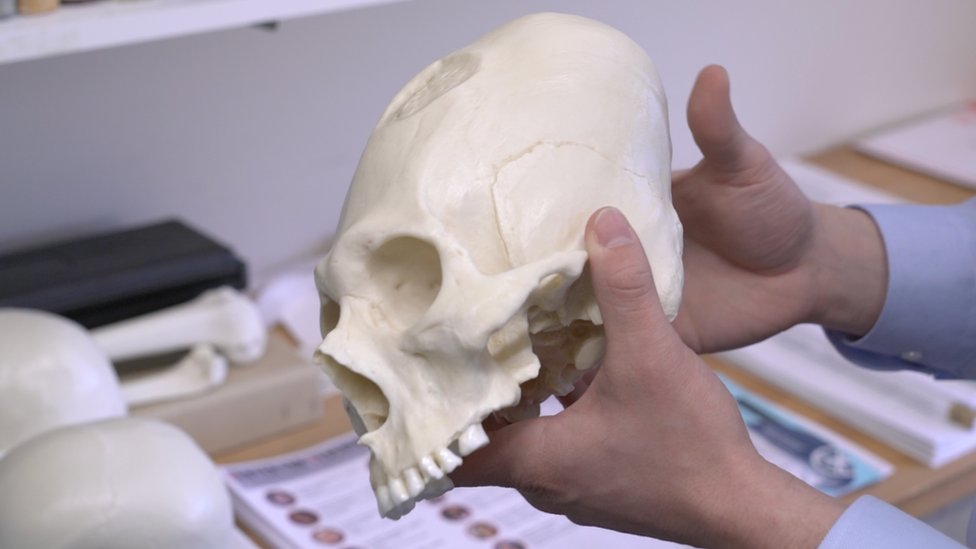 Cráneo cónico (Foto: Dan Chamberlain/Universidad Cornell)