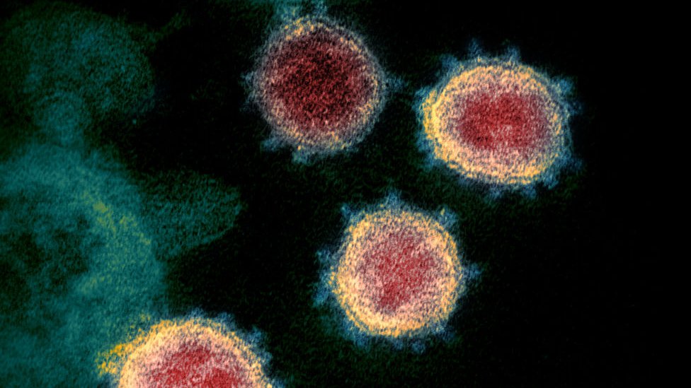Mutación del coronavirus: Sudáfrica investiga otra variante del patógeno  vinculada a su segunda ola de infecciones - BBC News Mundo
