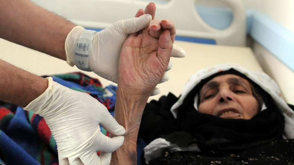 امرأة يشتبه في إصابتها بمرض الكوليرا في اليمن