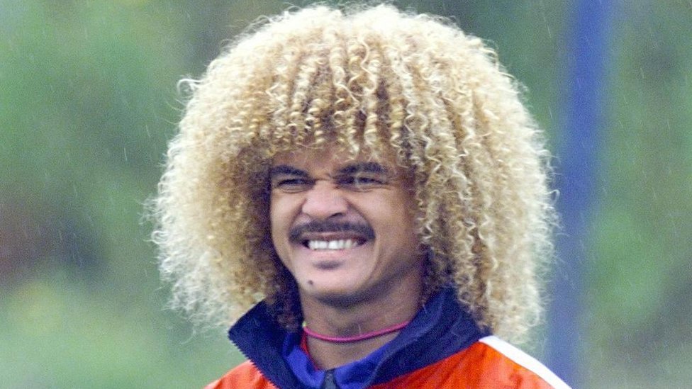 Carlos Valderrama, exjugador de fútbol de Colombia