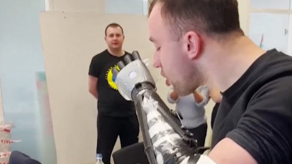 Ukrainian soldiers receive bionic arms