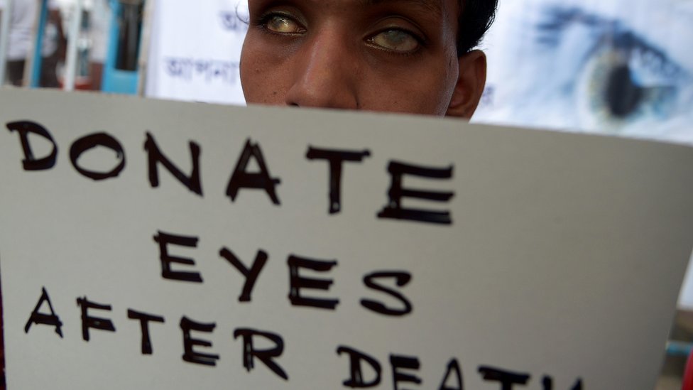 Ayollar mushukchalari