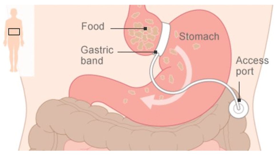 Yetuk ayol uni bir yigitga berdi