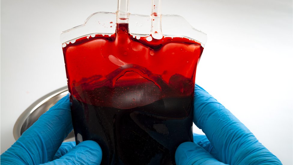 血液型をO型に変換、腸内細菌の酵素で カナダ研究 - BBCニュース