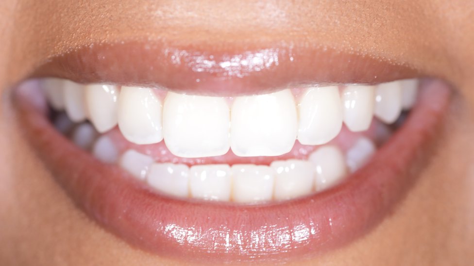 Prótese Dentária Em Fundo Azul, Close-up. Velhice. Dentes. Jaw