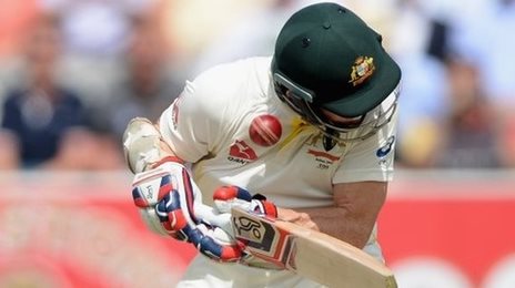 Bouncer gives Rogers 'ear problem'