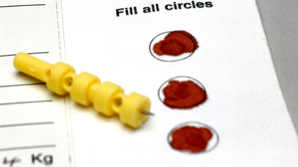 Нацистік неміс концлагерьлеріндегі жыныстық эксперименттер