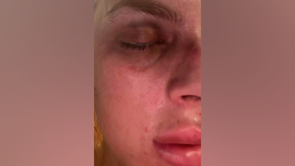 Domestic abuse survivor thought she would die