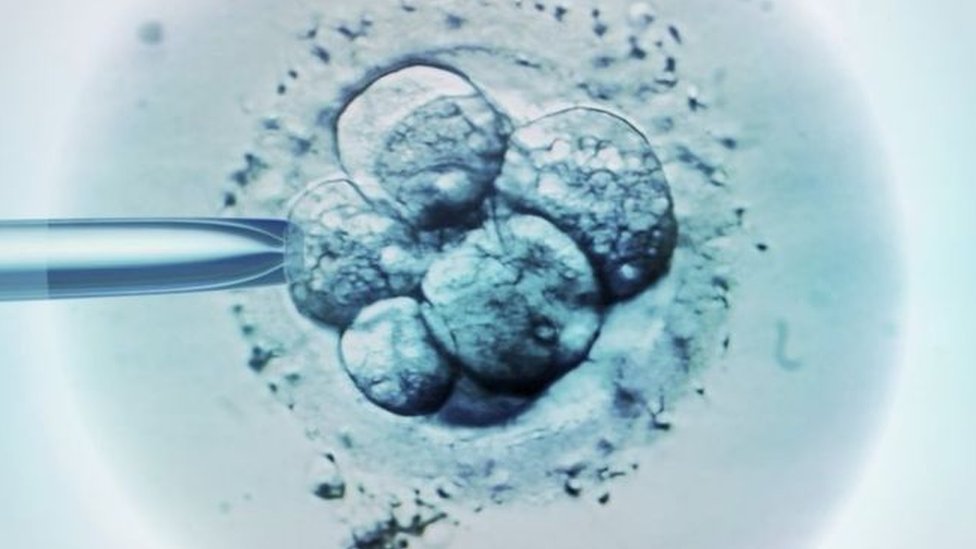 ЭКО(IVF) и искусственное оплодотворение спермой донора