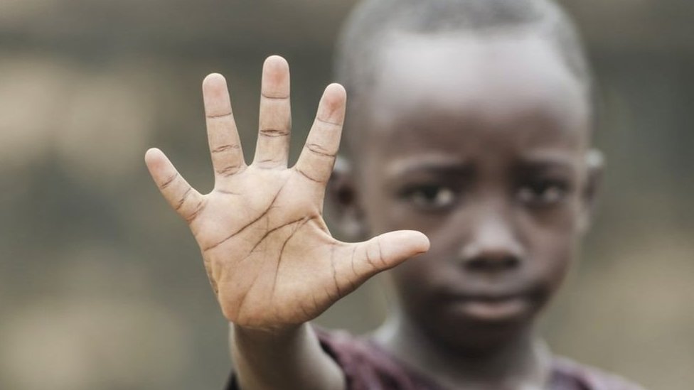Niño muestra su mano