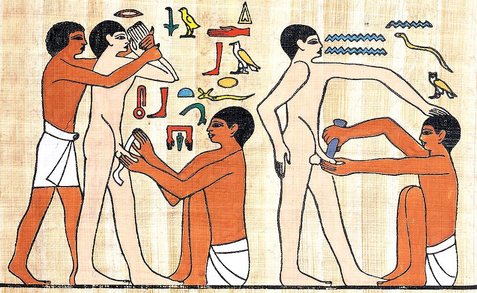 Circuncisión