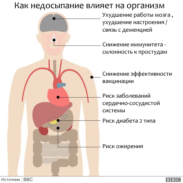 Когда перестаешь дышать: история человека с апноэ сна