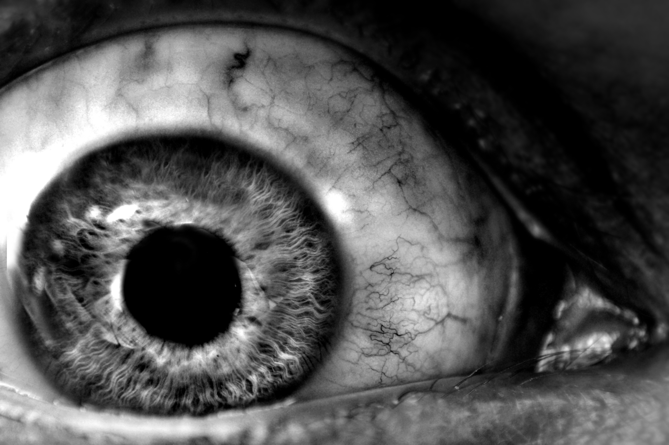 Eye