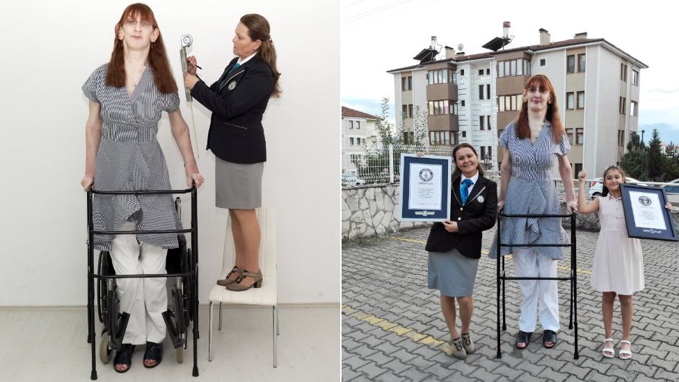 Tallest woman in the world: Turkey Rumeysa Gelgi na Guinness World