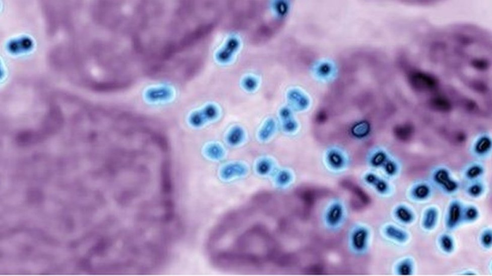 Halat kiygan seksual qiz