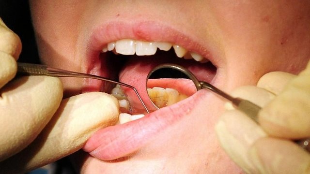 Как связаны цвет эмали зубов и их здоровье?