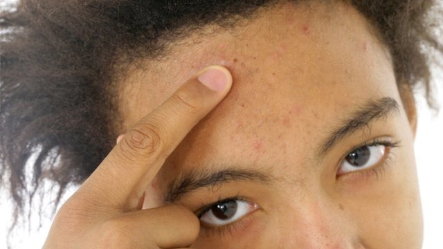 Кеудемді қыз массаж жасайды