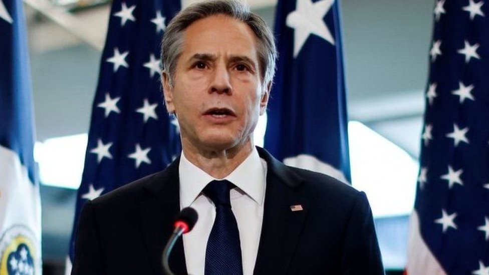 Rossiya estrada qoshiqchilari Anna Semenovichning porno videolarini tomosha qiling