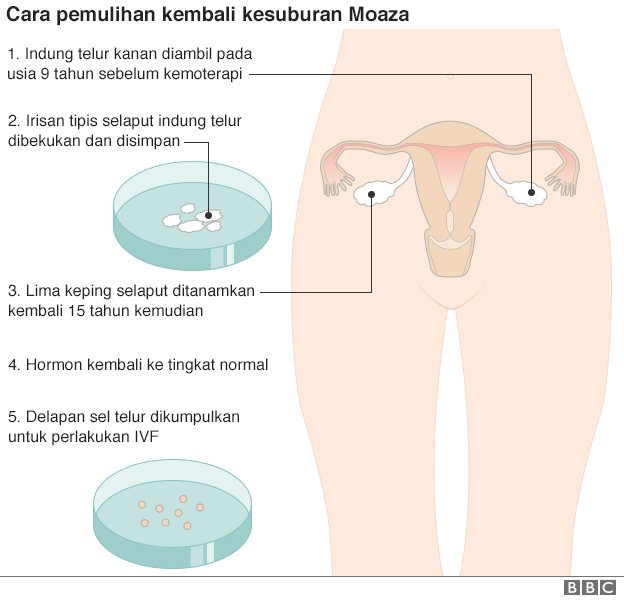 Pemulihan kembali kesuburan Moaza dilakukan beberapa tahap.