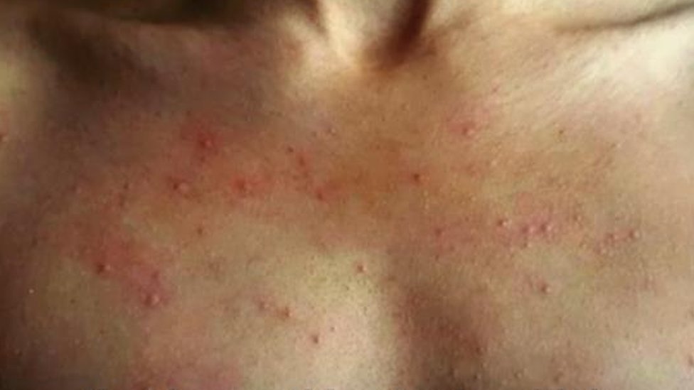 Transseksuallar ozlariga blowjob beradi