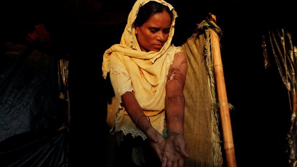 Rohingya lady Anwara Begum