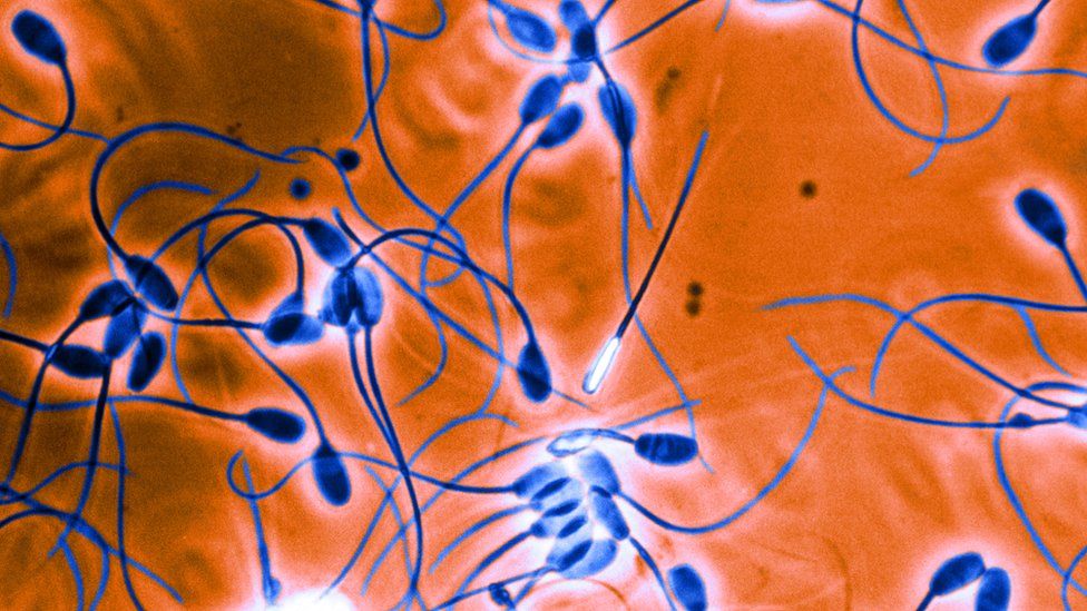 Yalangoch va pantyless fotosuratlar