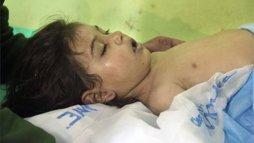 طفلة تصارع الموت جراء تنشقها غاز السارين في خان شيخون