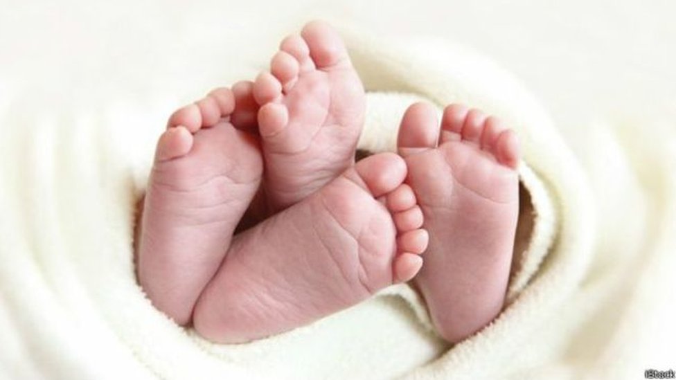 क्यों पैदा होते हैं चार हाथ-चार पांव वाले बच्चे? - BBC News हिंदी