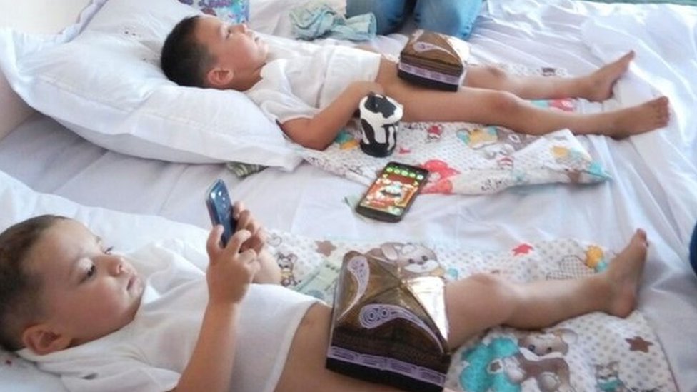 Sohilda sunnat qilingan jinsiy olatni Sohilda sunnat qilingan jinsiy olatni