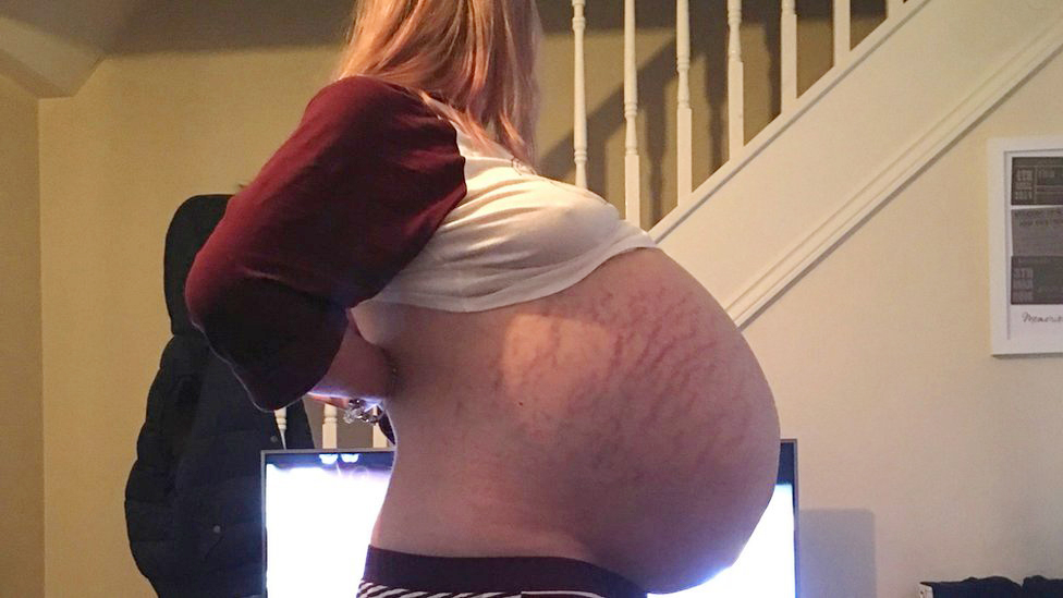 Swollen pregnant belly