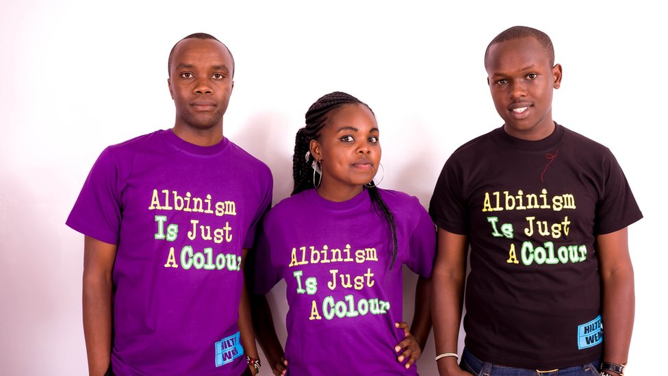 Albinism Is Just A Colour campaigners