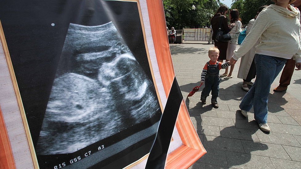 В России ввели специальную лицензию на проведение абортов