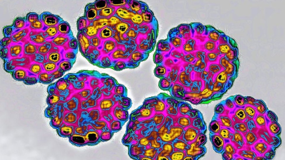 Lezbiyenlar mushukni yalaydilar