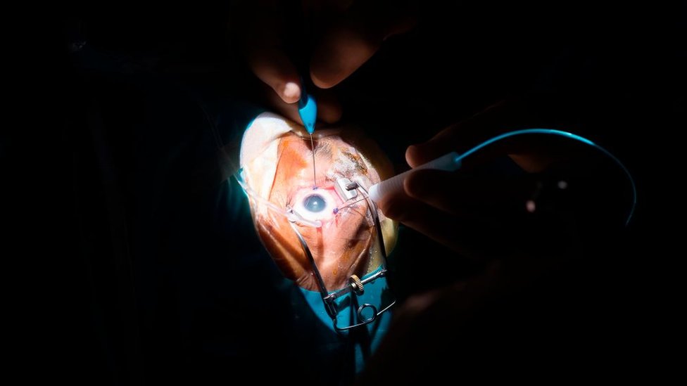 Mushuk va eshakning porno suratlari