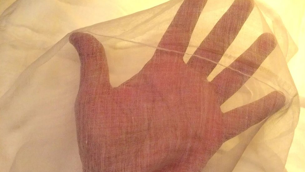 Dikli mushaklarning fotosuratlari Dikli mushaklarning fotosuratlari